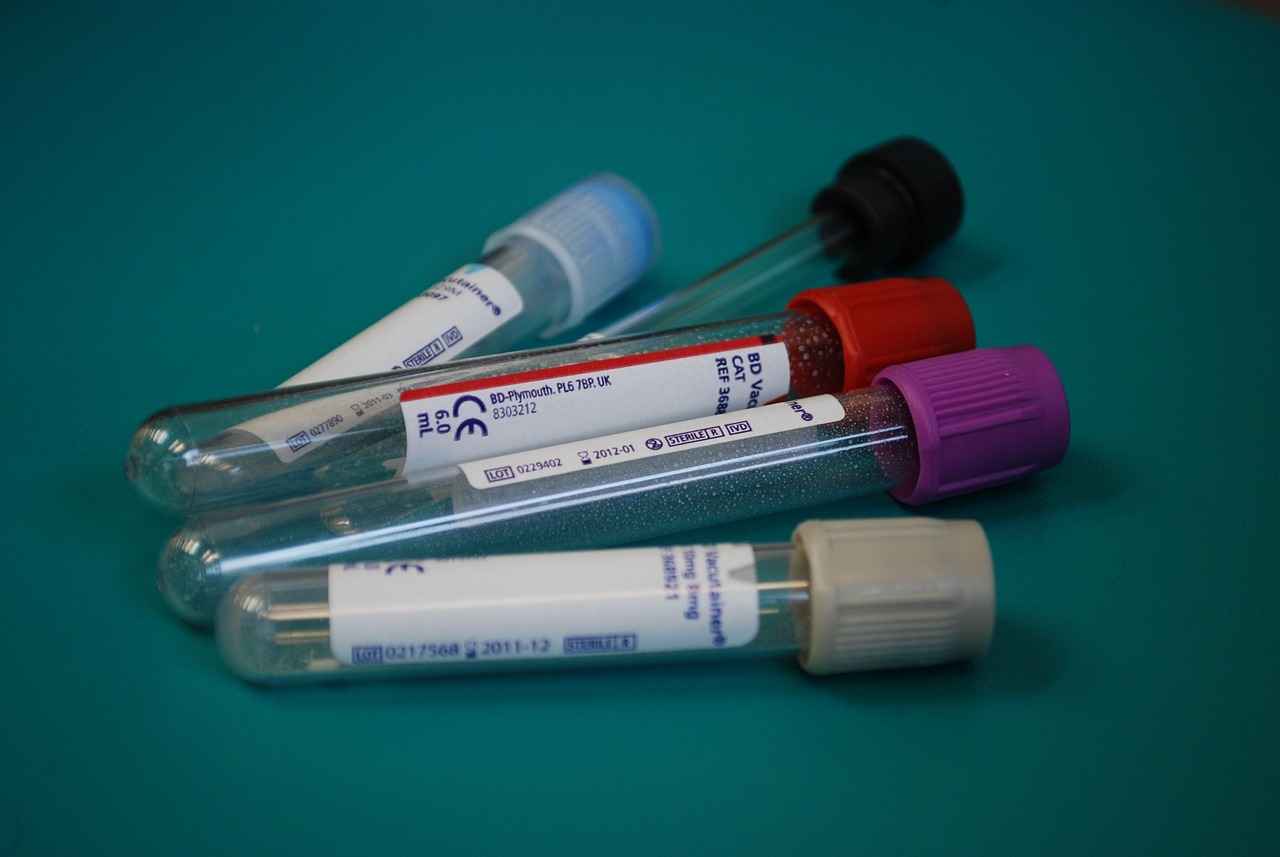 Understanding Blood Work Fasting