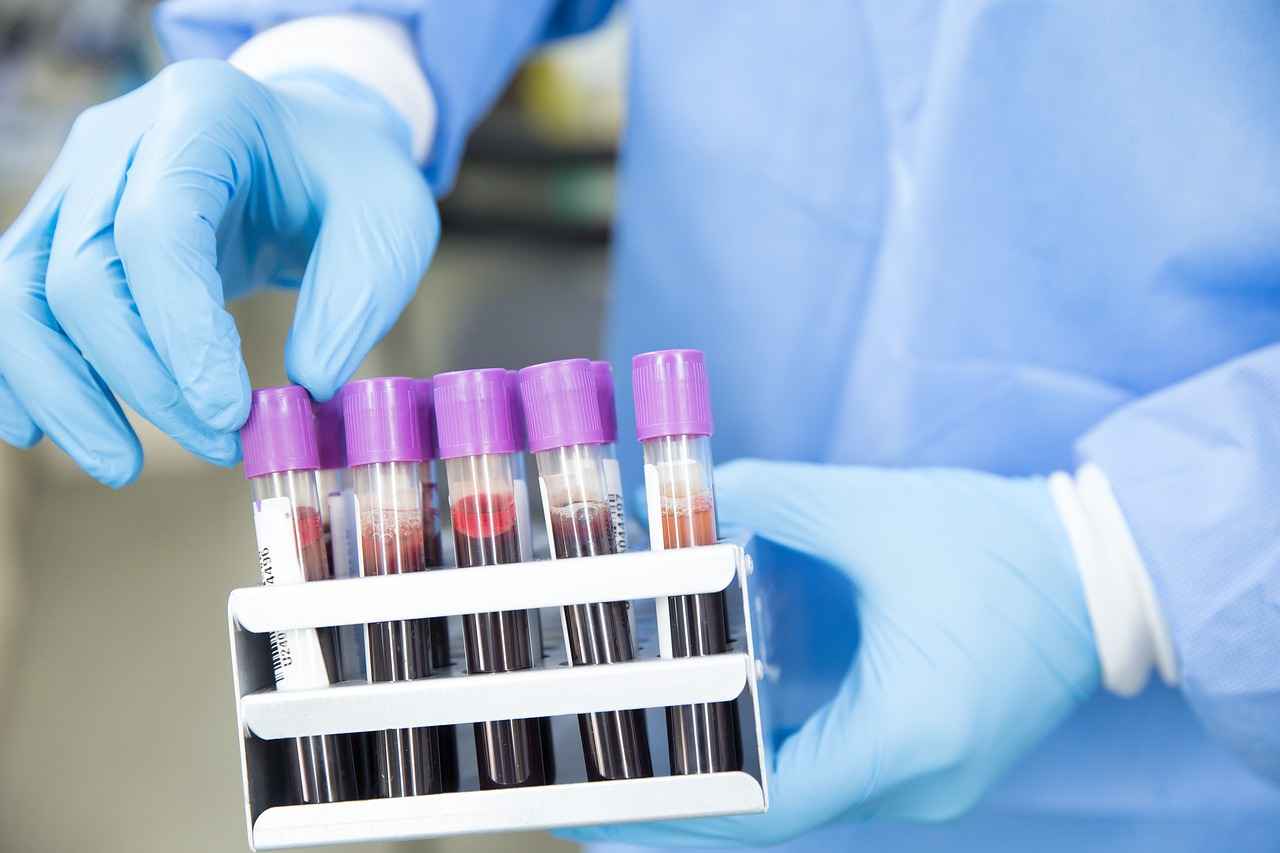 Why Is Fasting Important Before Blood Tests?