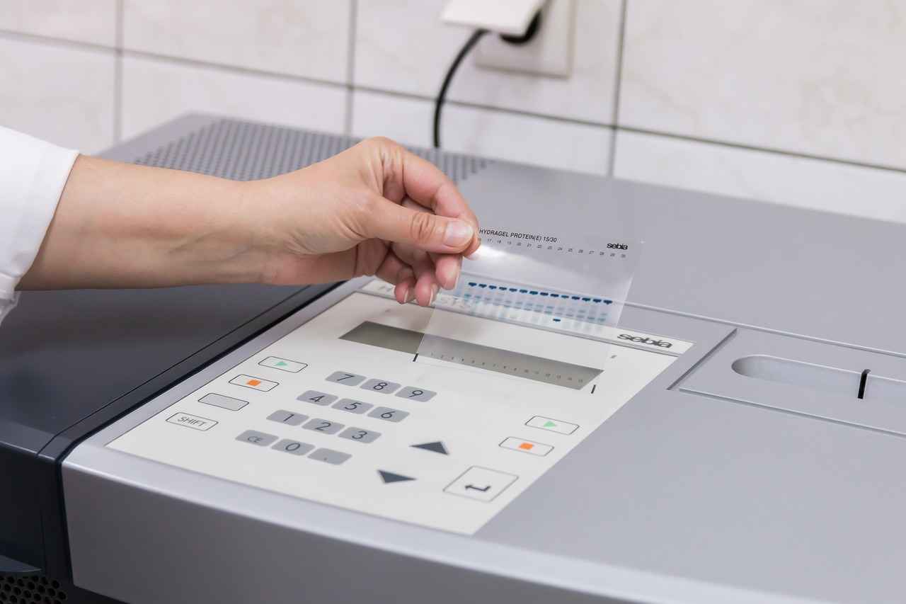 Can You Drink Water Before a Fasting Blood Sugar Test? 2 Why Fasting is Required